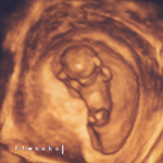 11 week scan