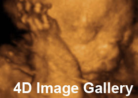 4d_gallery_banner.jpg
