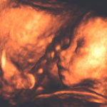 4d_image_10_small.jpg