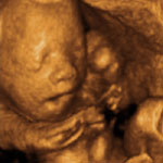 4d_image_2_small.jpg