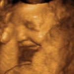4d_image_5_small.jpg