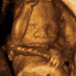 4d_image_7_small.jpg