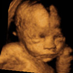 4d_image_8_small.jpg