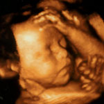4d_image_9_small.jpg