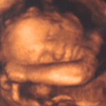Baby Chapman