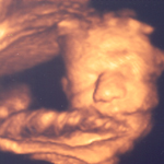 Baby Chatterton
