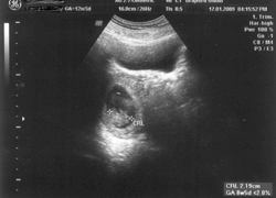 Dating ultrasound pictures