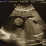 growth_scan_home.jpg