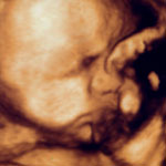 Baby Luke